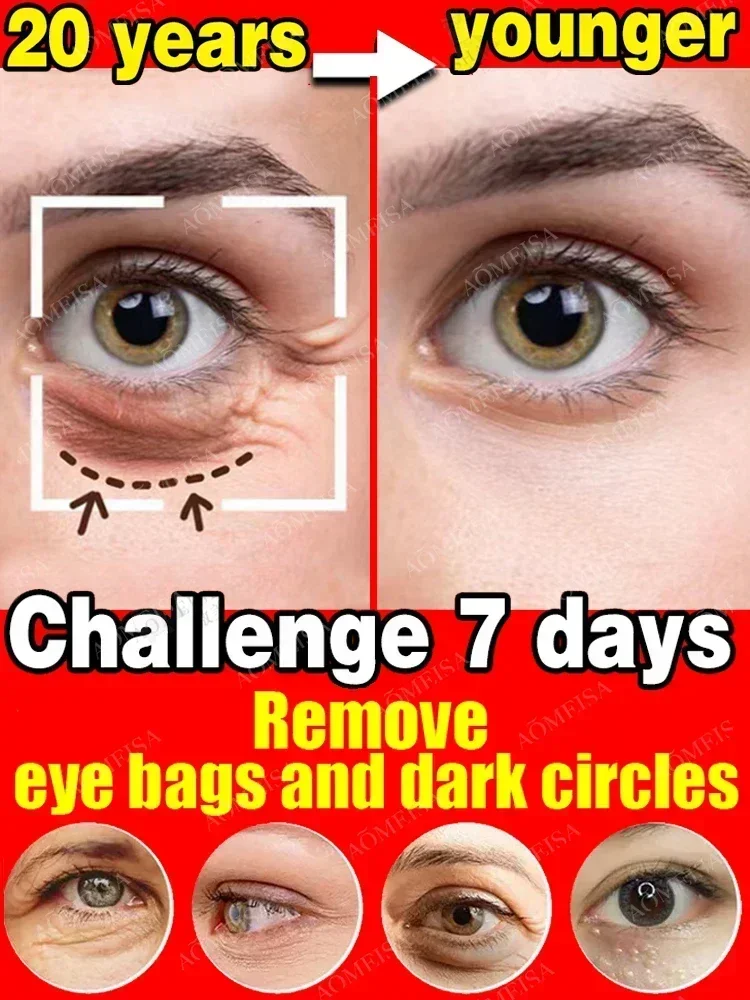New 7 Day Tighten Wrinkles Eye - đánh giá và giá Oligopeptide Wrinkle