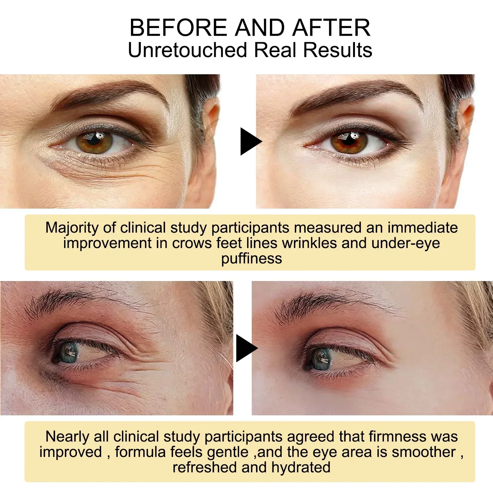New 7 Day Tighten Wrinkles Eye - đánh giá và giá Oligopeptide Wrinkle